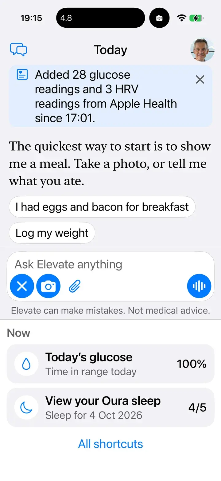 The Now tray in Elevate: Today's glucose, 100% in range, and View your Oura sleep, 4 out of 5.